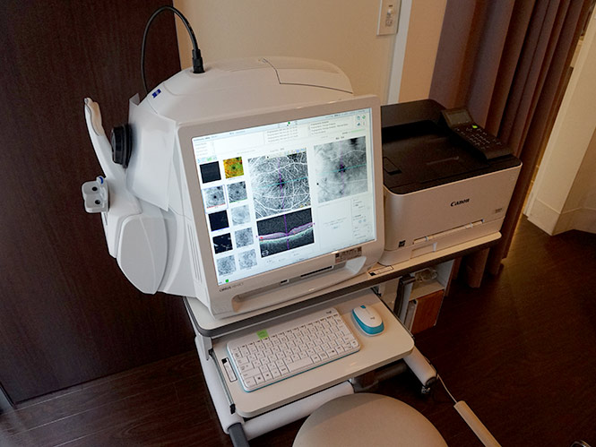 光干渉断層血管撮影機器(OCTA)